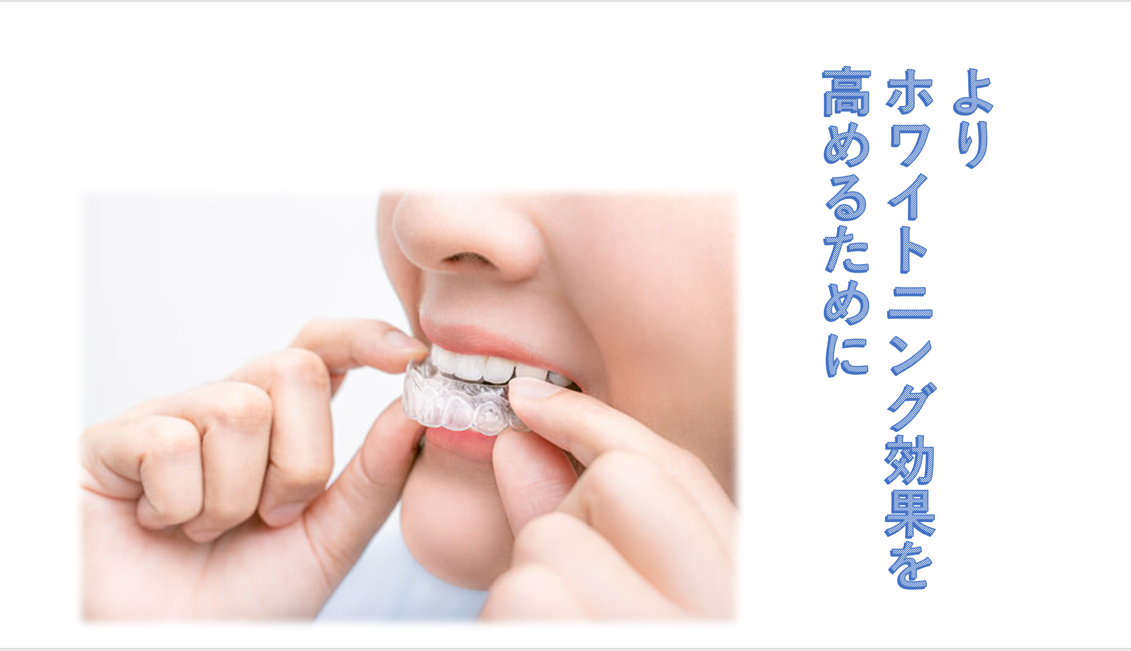 ホワイトニングを効果的にするには？ - 宮崎市の歯医者 谷山歯科医院